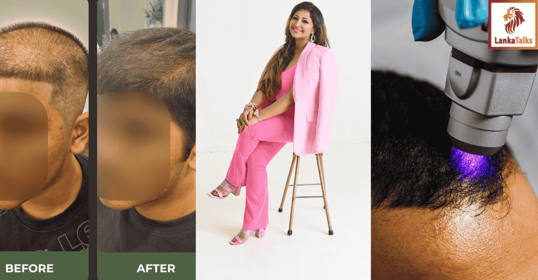 Christell Luxury Wellness Unveils Sri Lanka’s First-Ever Specialty Hair Restoration Clinic with Advanced Regenerative Therapies